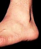 leftfoot.jpg (3855 bytes)